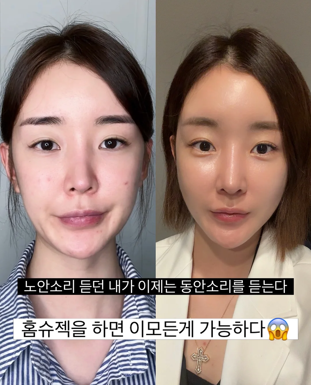 하이체어, 젖병 소독기, 젖병 세제&솔, 분유포트, 쉐이커, 침대 가드, 아기 장난감 8