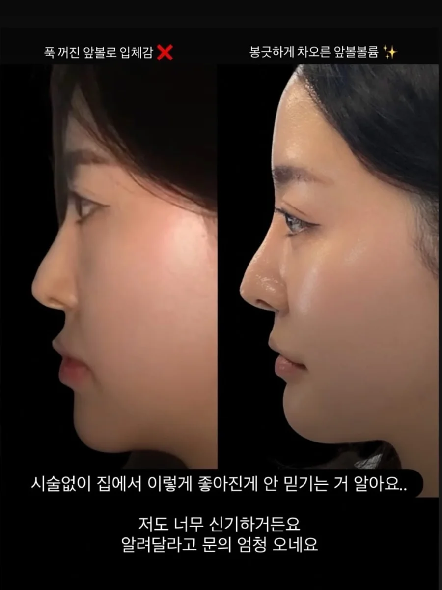 꽃화동 클리어 케이스 11