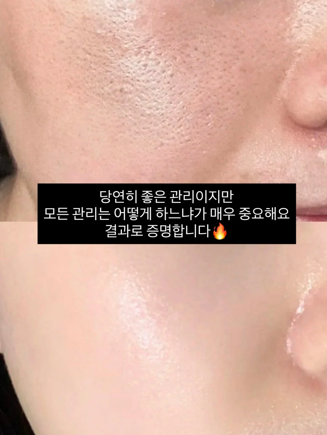 꽃화동 클리어 케이스 12