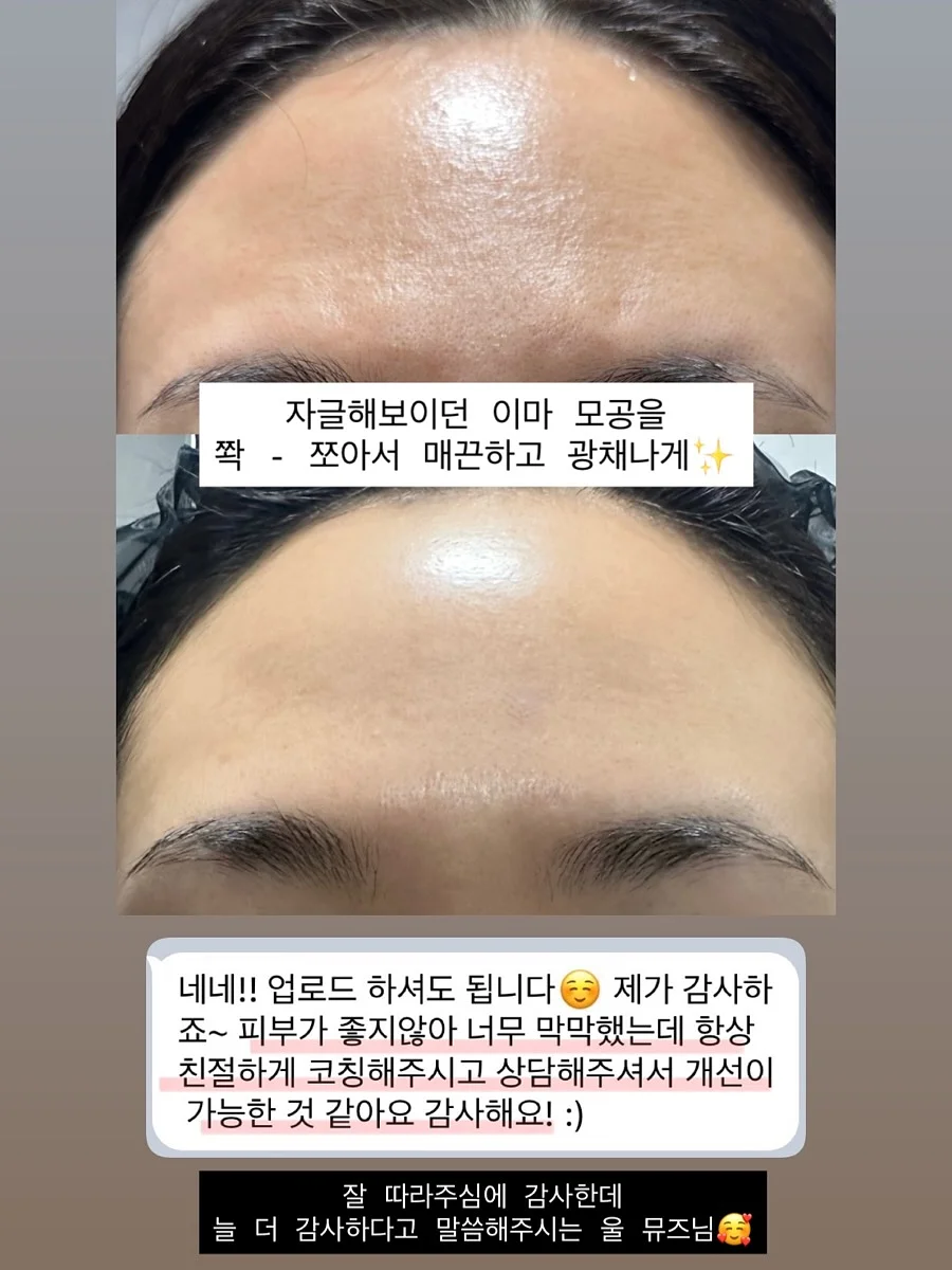 꽃화동 클리어 케이스 13