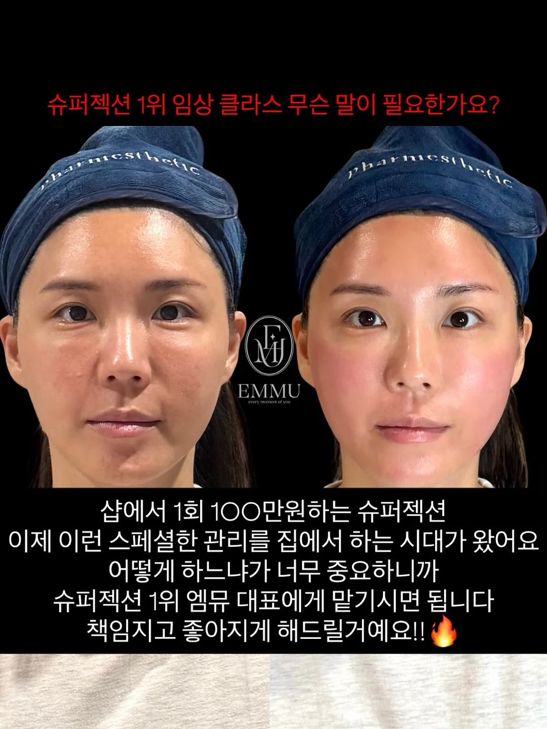 꽃화동 클리어 케이스 10