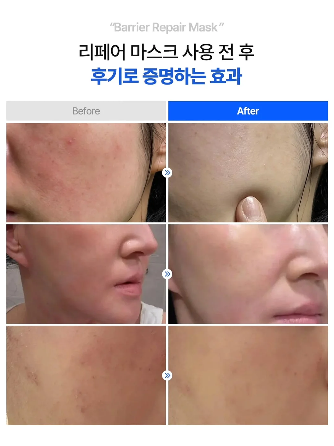 헤어밴드 5