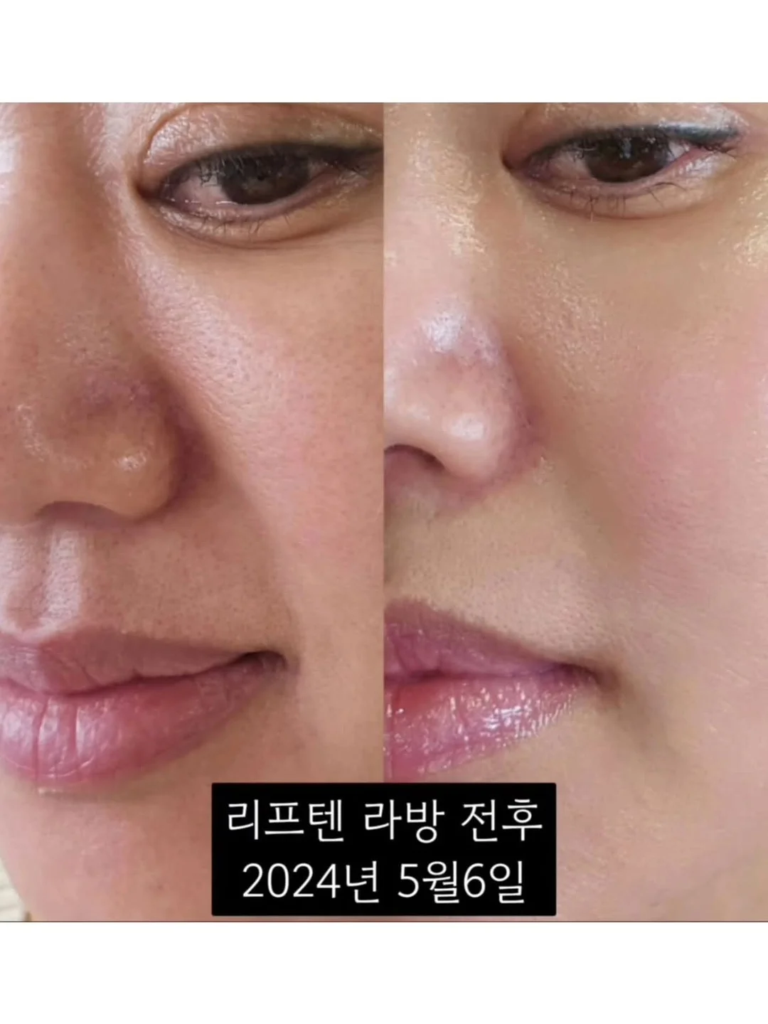 오이 마운자로 11