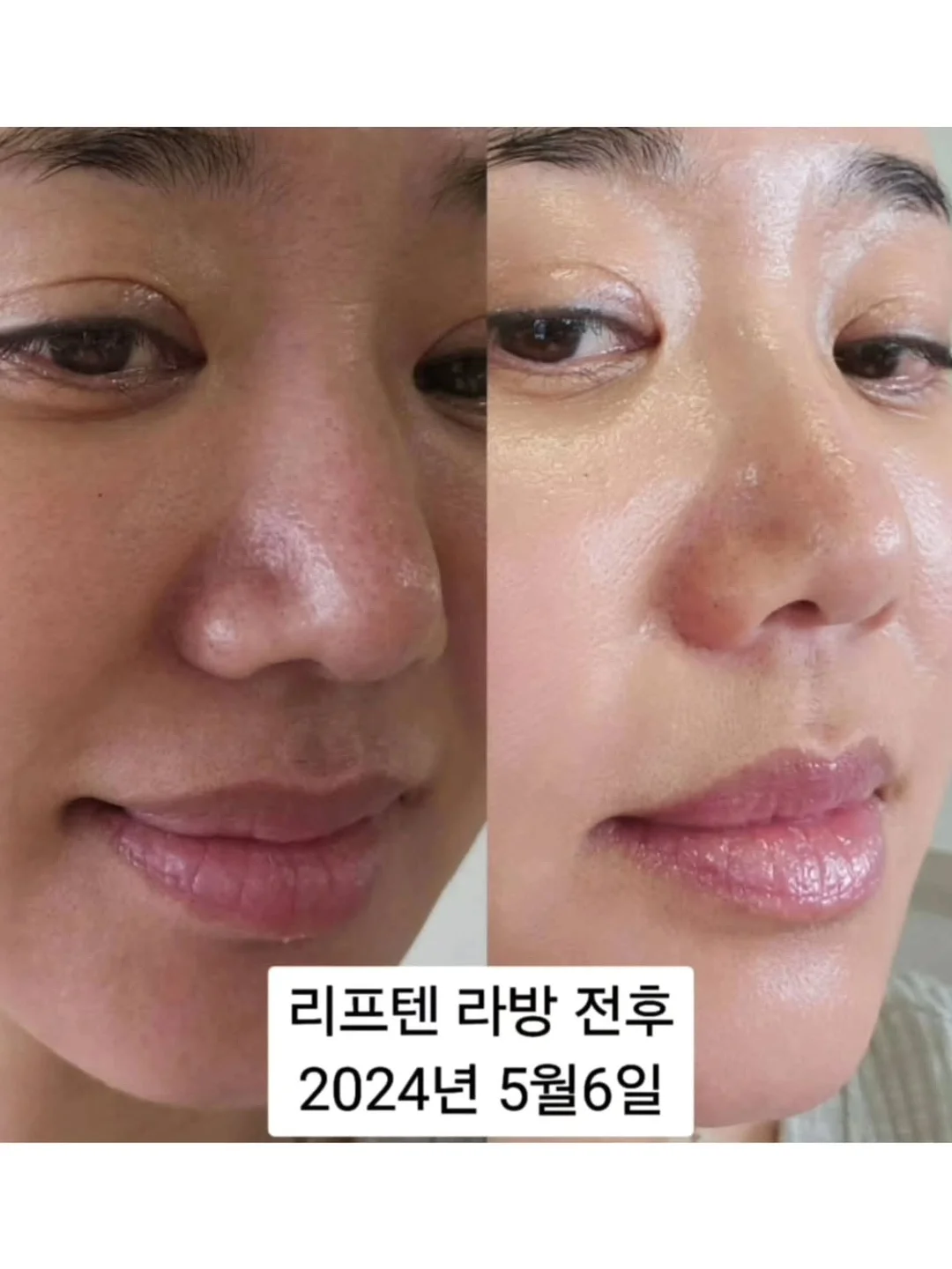 오이 마운자로 13