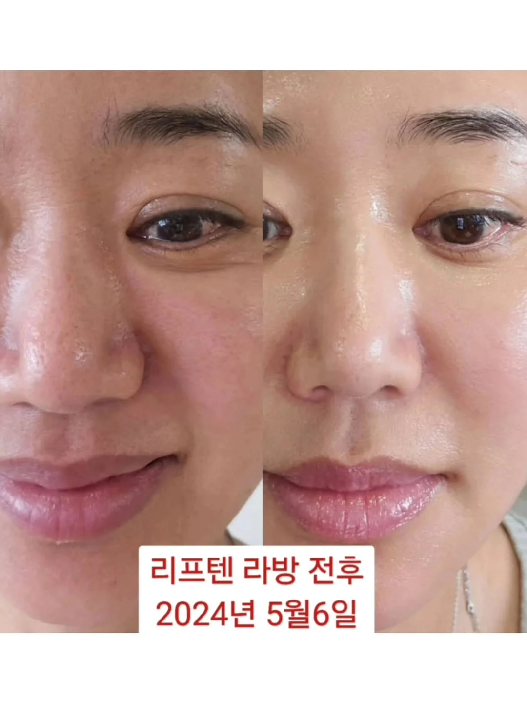 오이 마운자로 15