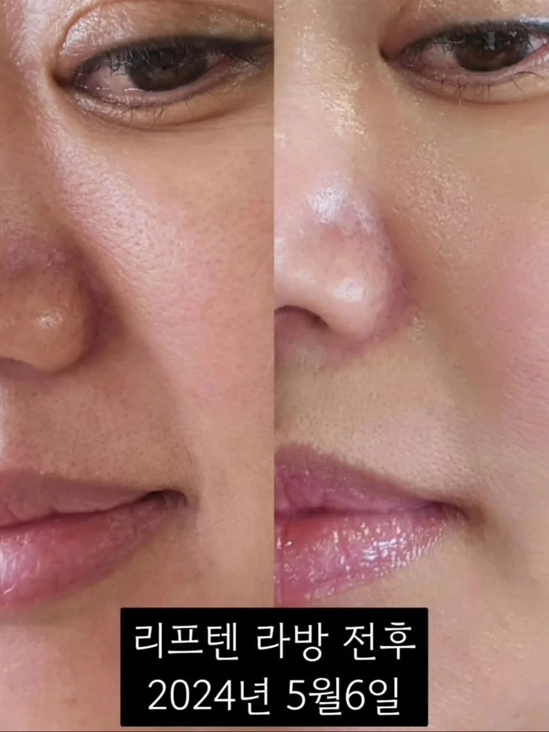 오이 마운자로 16
