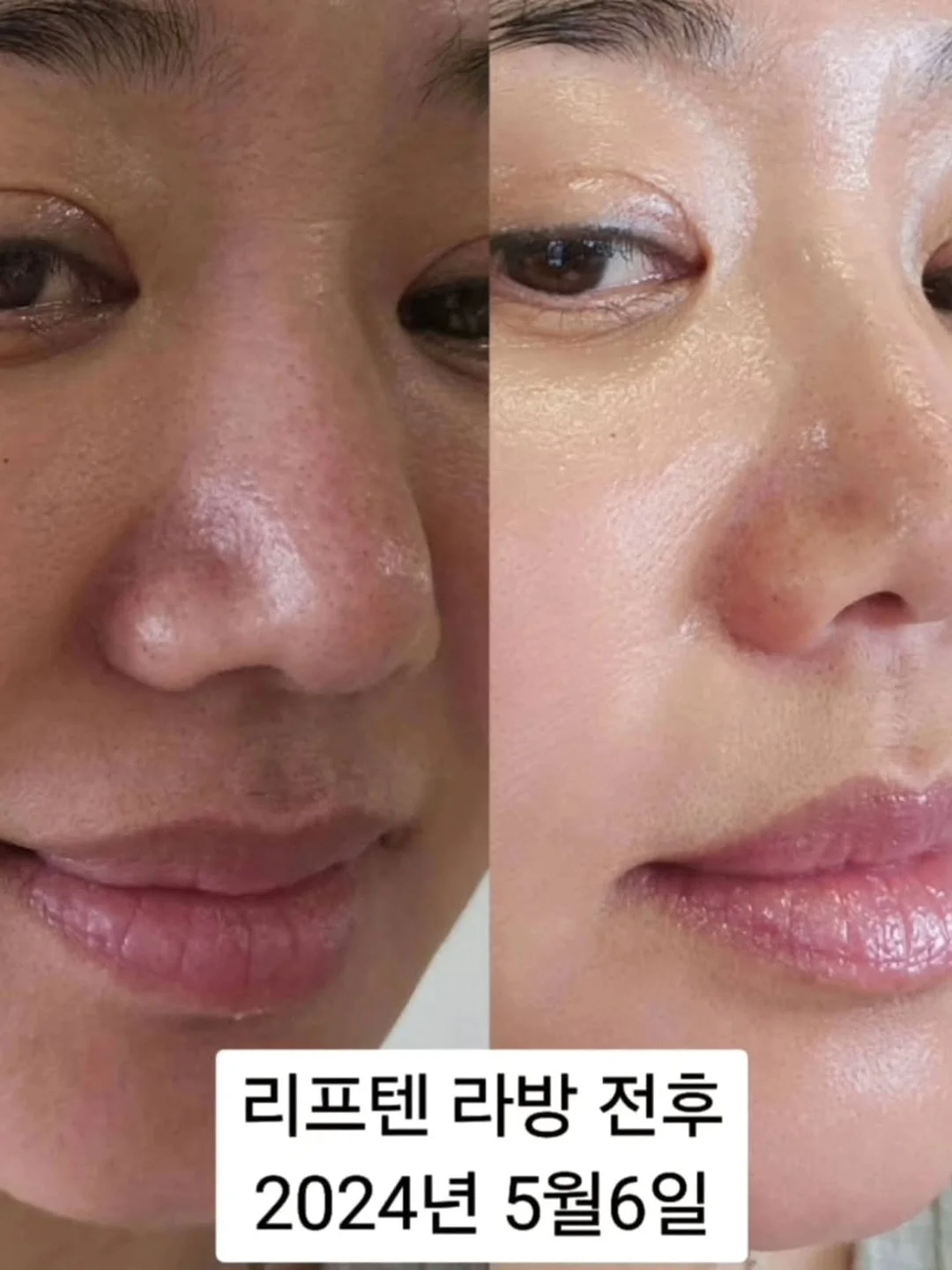 오이 마운자로 17