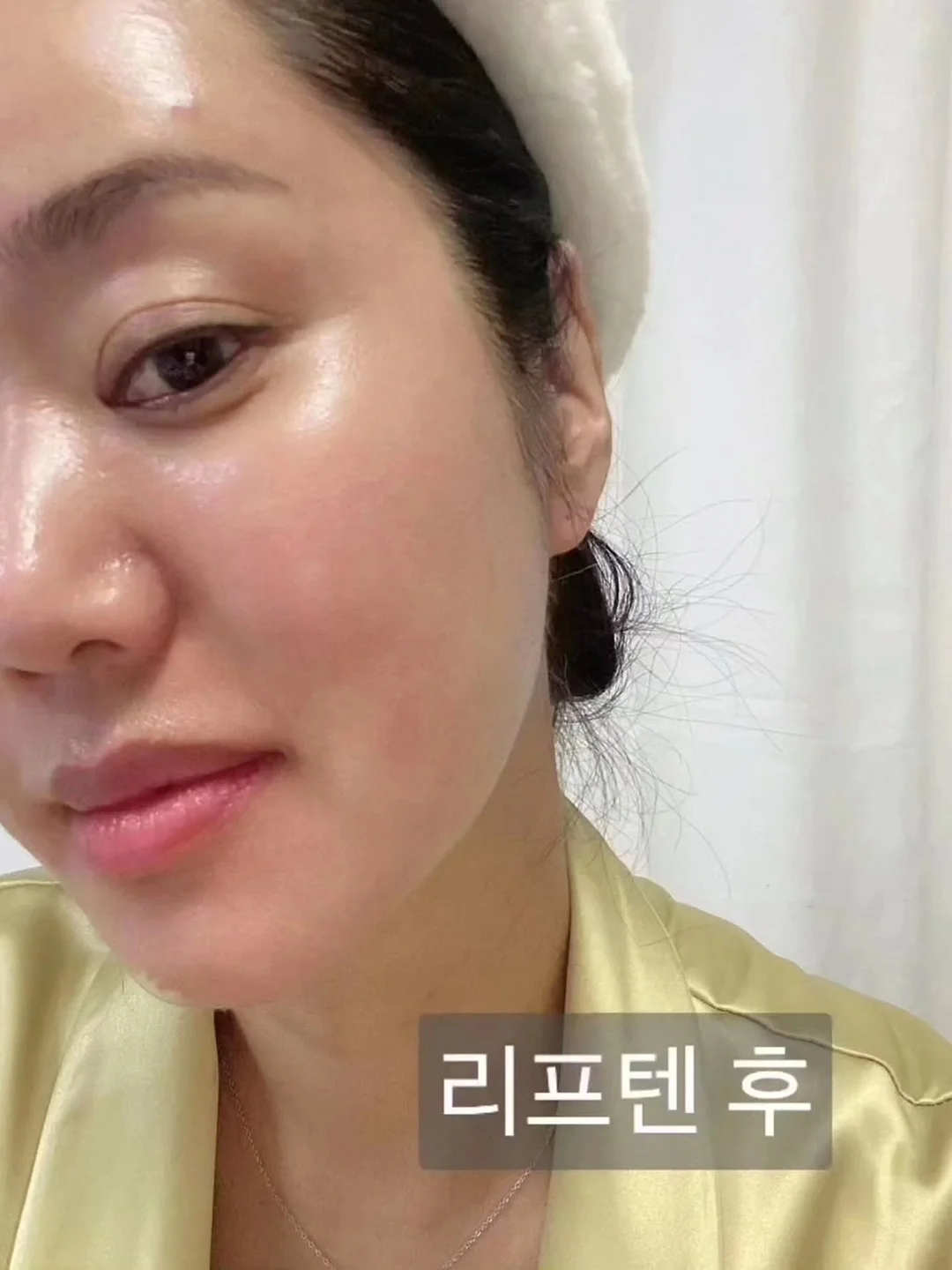 오이 마운자로 20