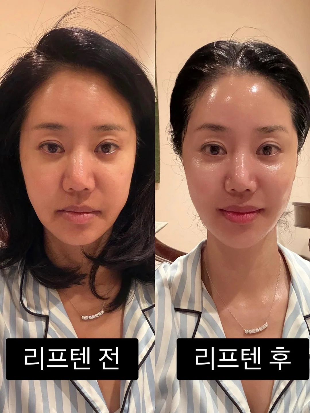 오이 마운자로 5