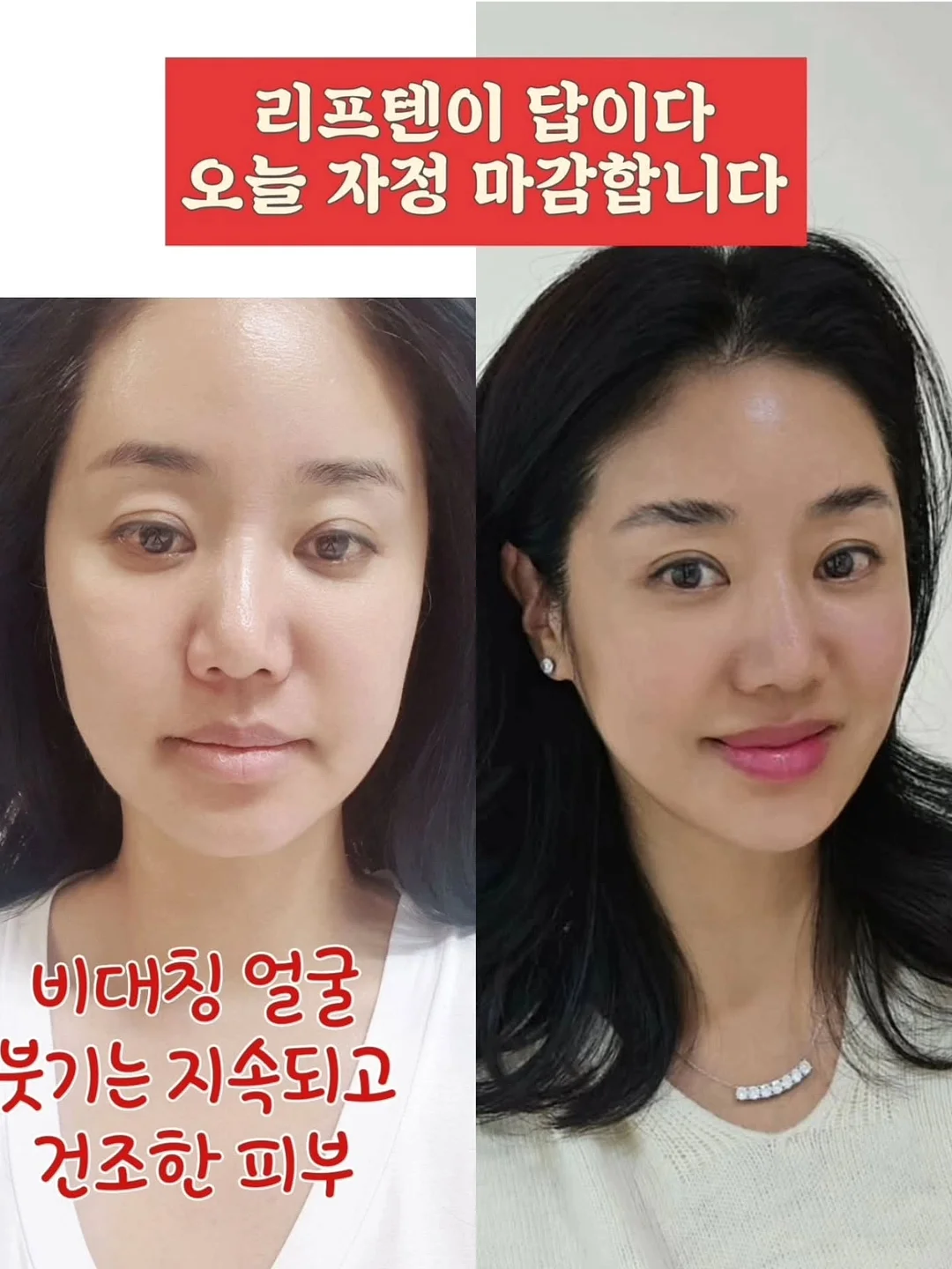오이 마운자로 9