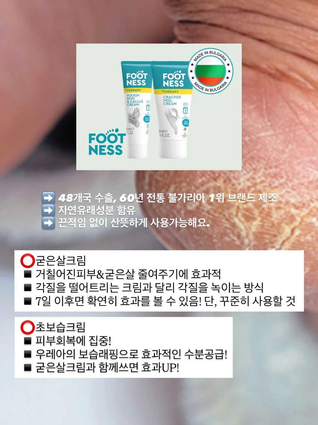 아마 옷 4