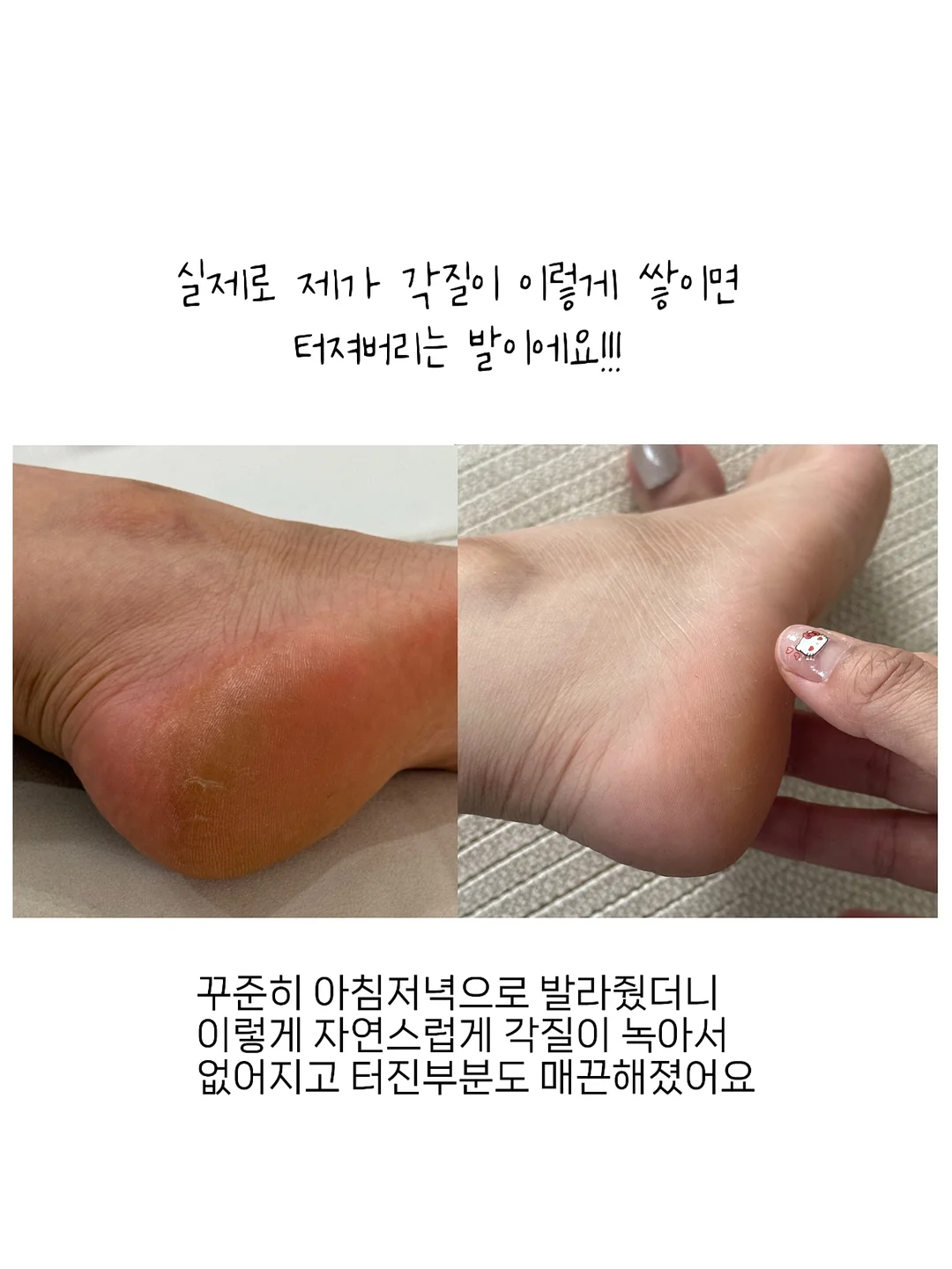 아마 옷 6
