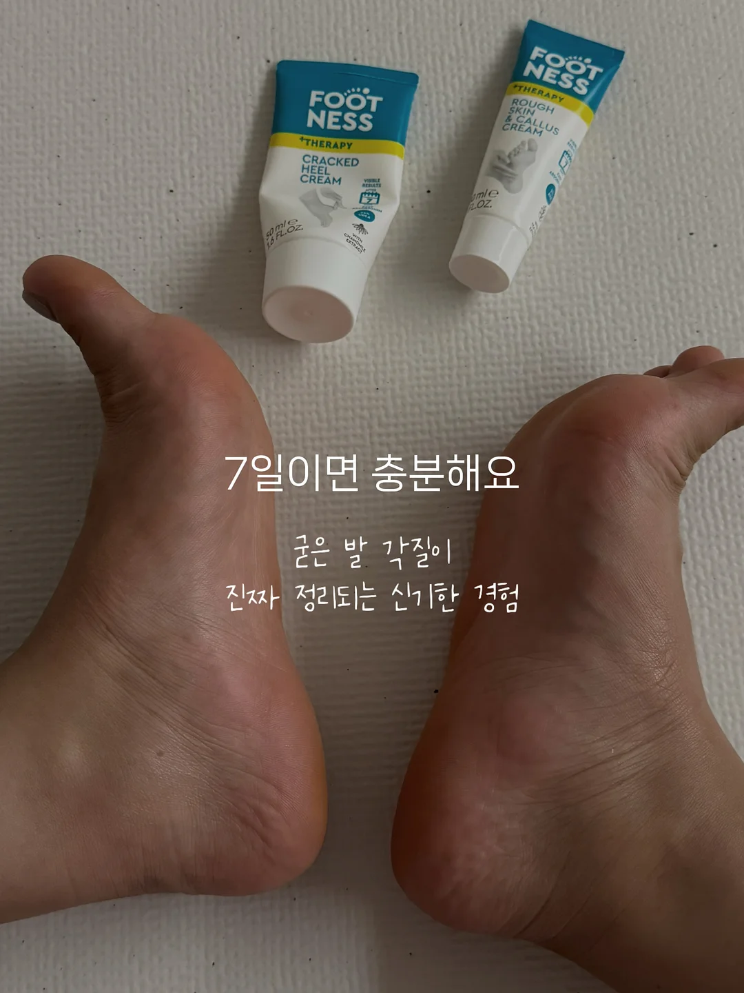 아마 옷 8