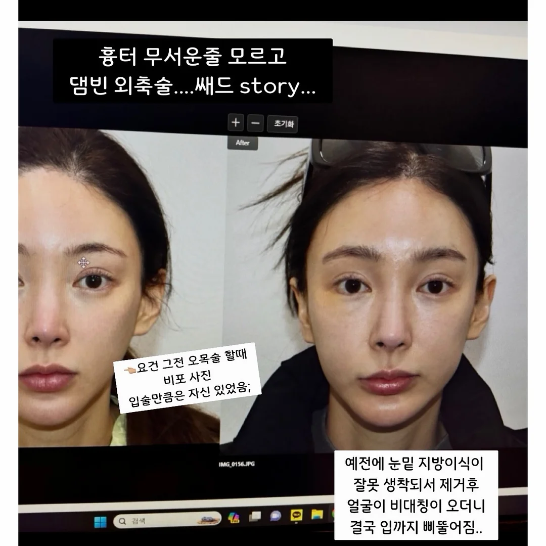 브라운 마그넷 2