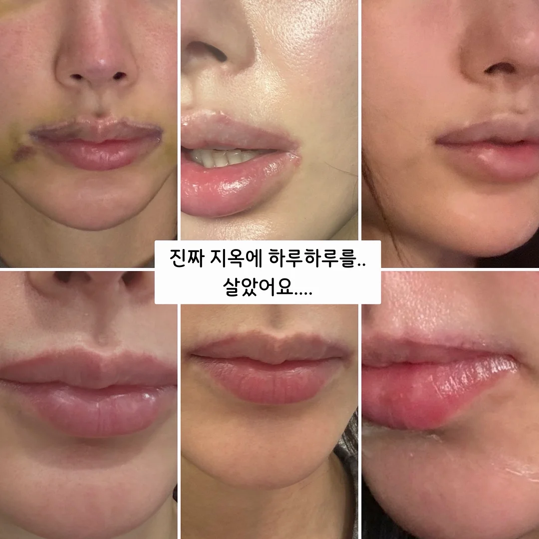 브라운 마그넷 3