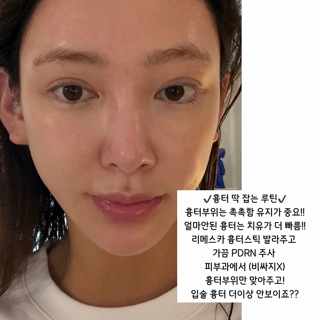 브라운 마그넷 9