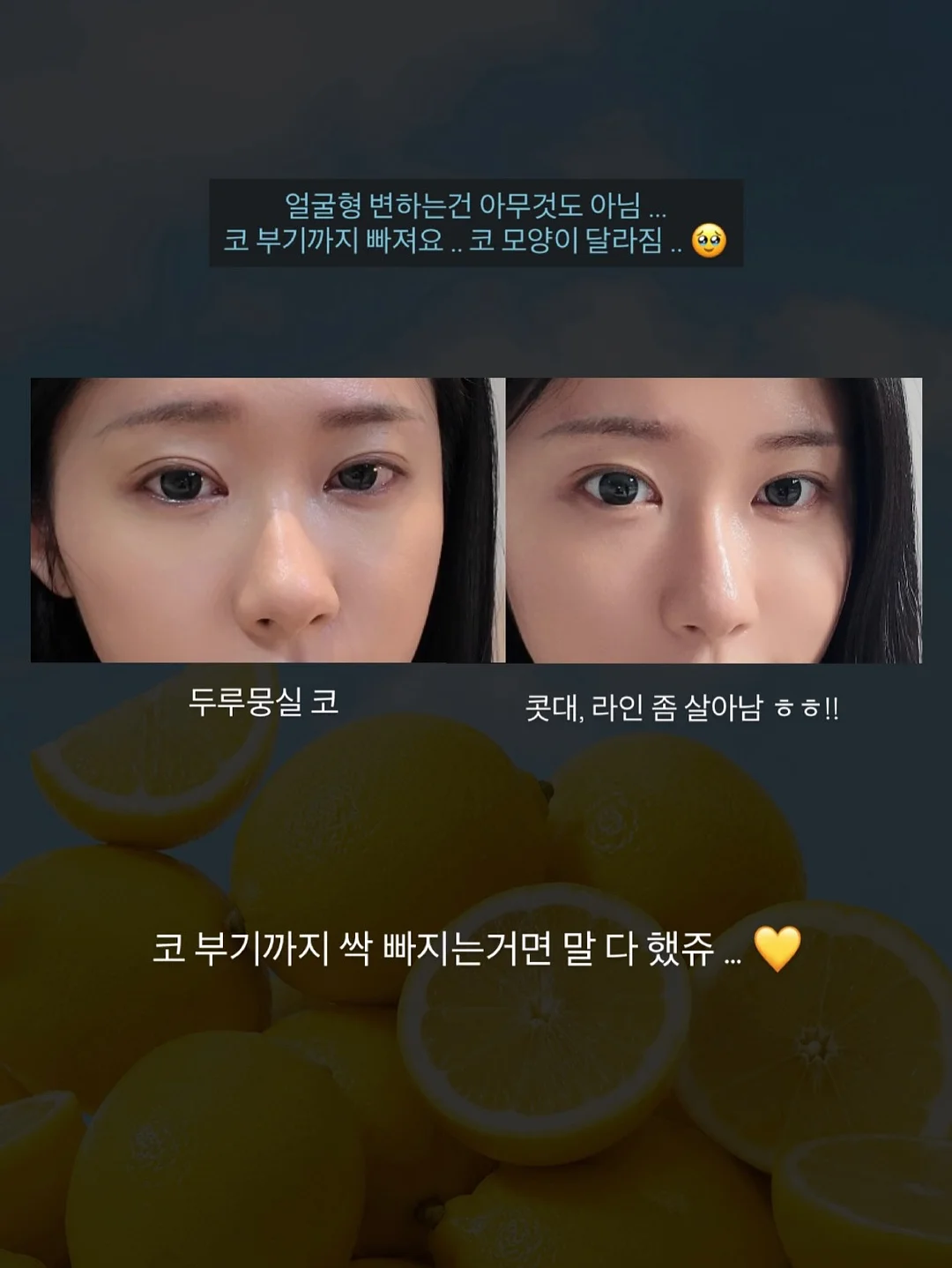 팡팡 실내복 8