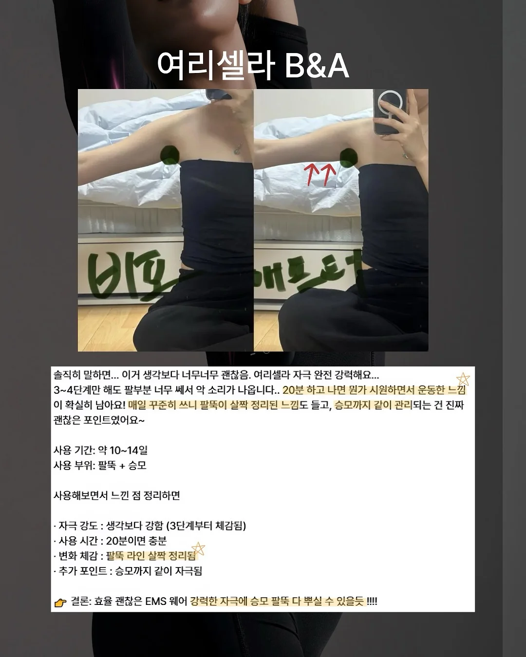 관절 패치 8