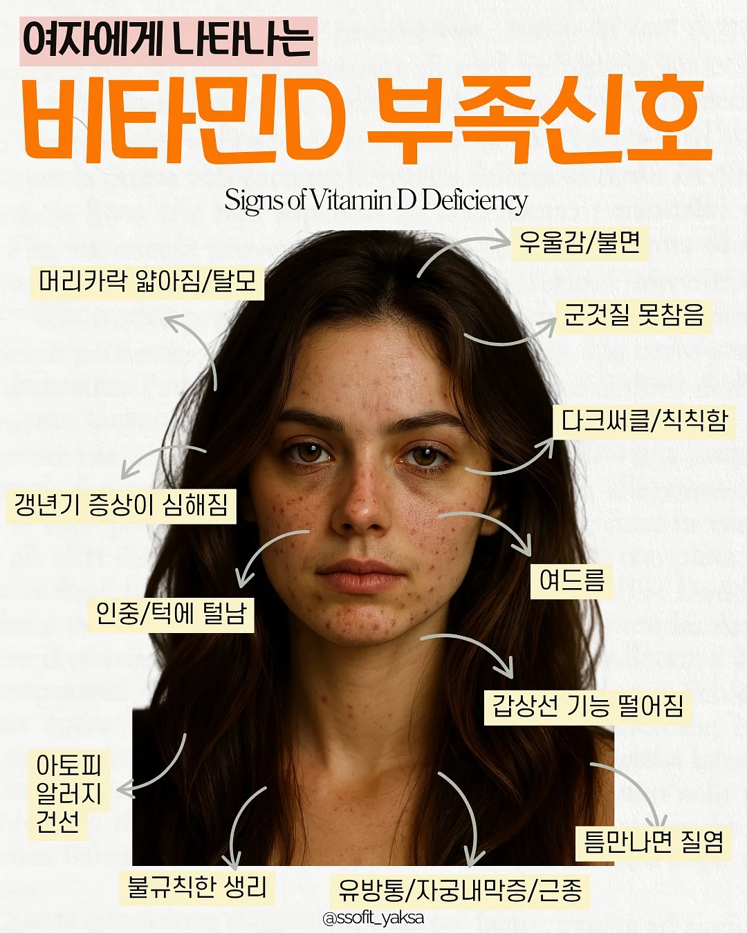 우디베베 헤이카슈트 1