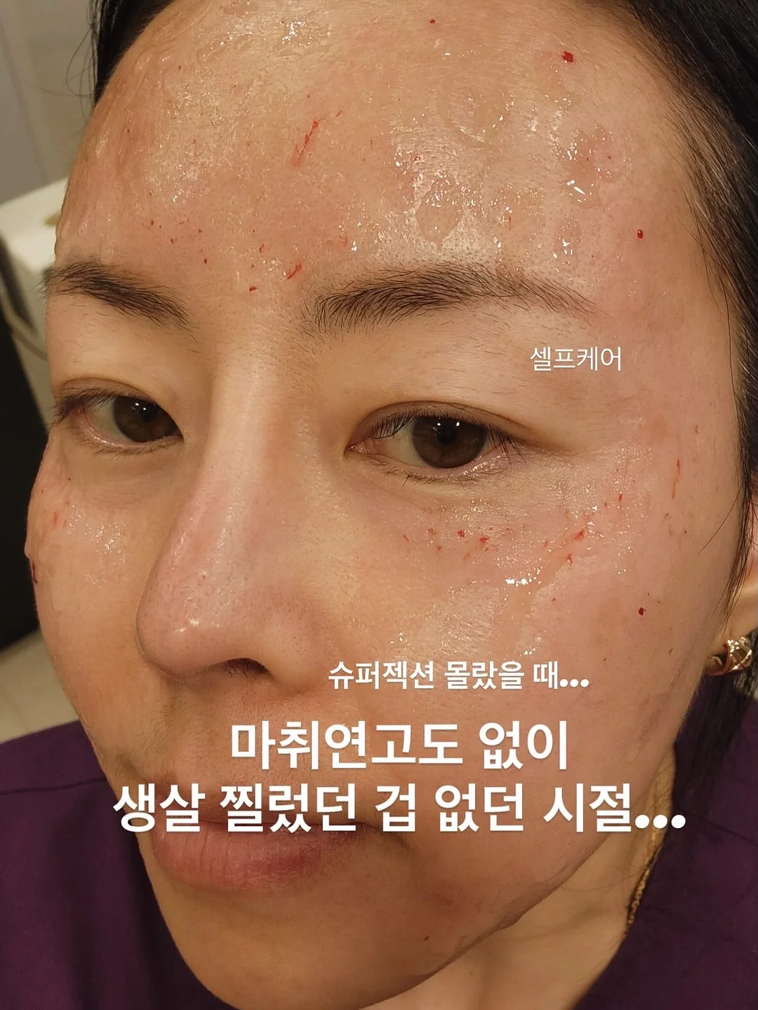씬님팬티 여름버전 1