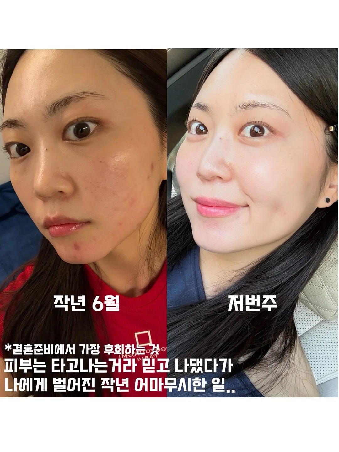 수입 구조 8가지 1