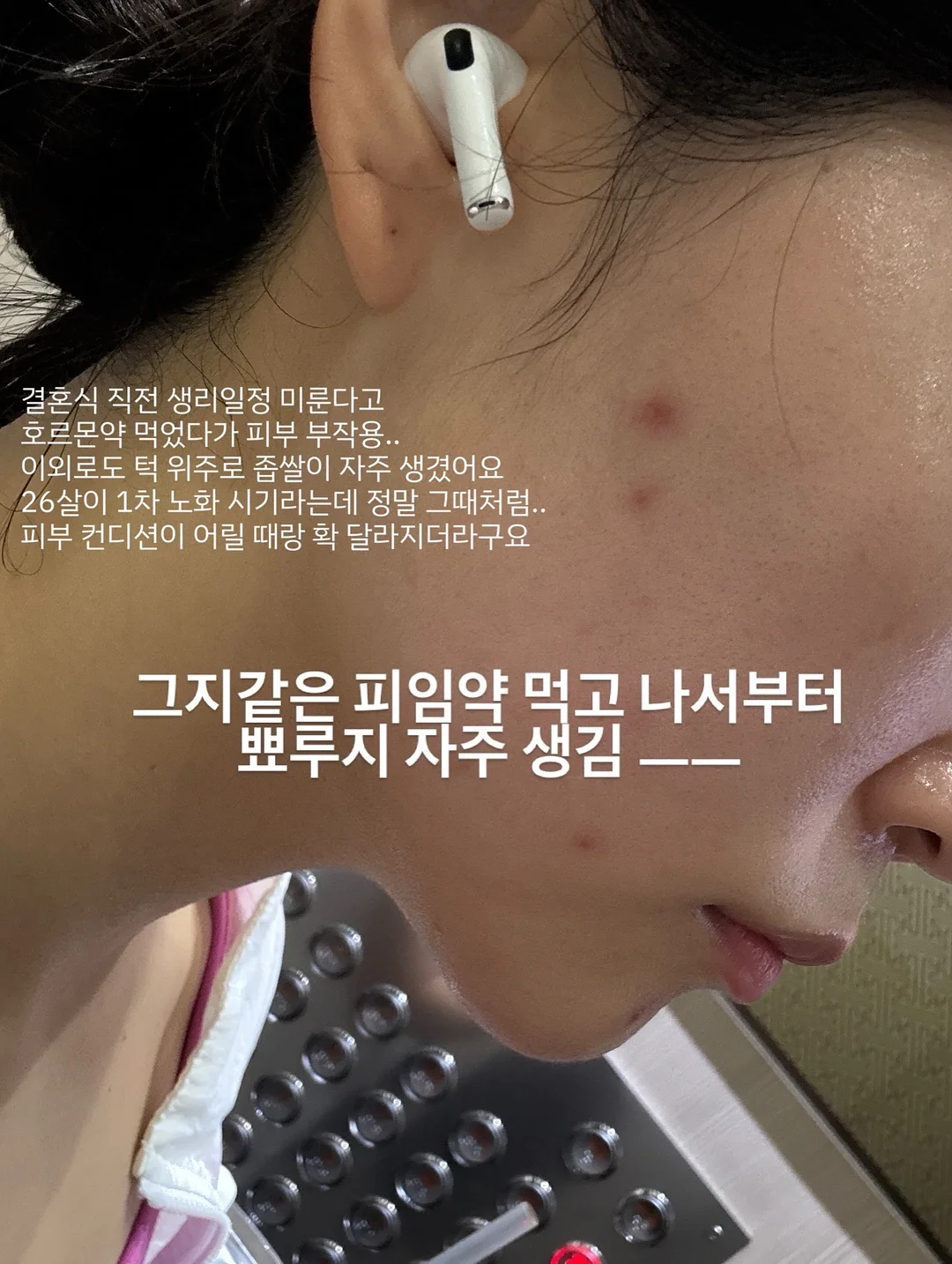 수입 구조 8가지 2