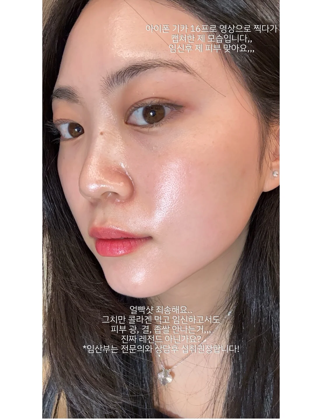 수입 구조 8가지 9