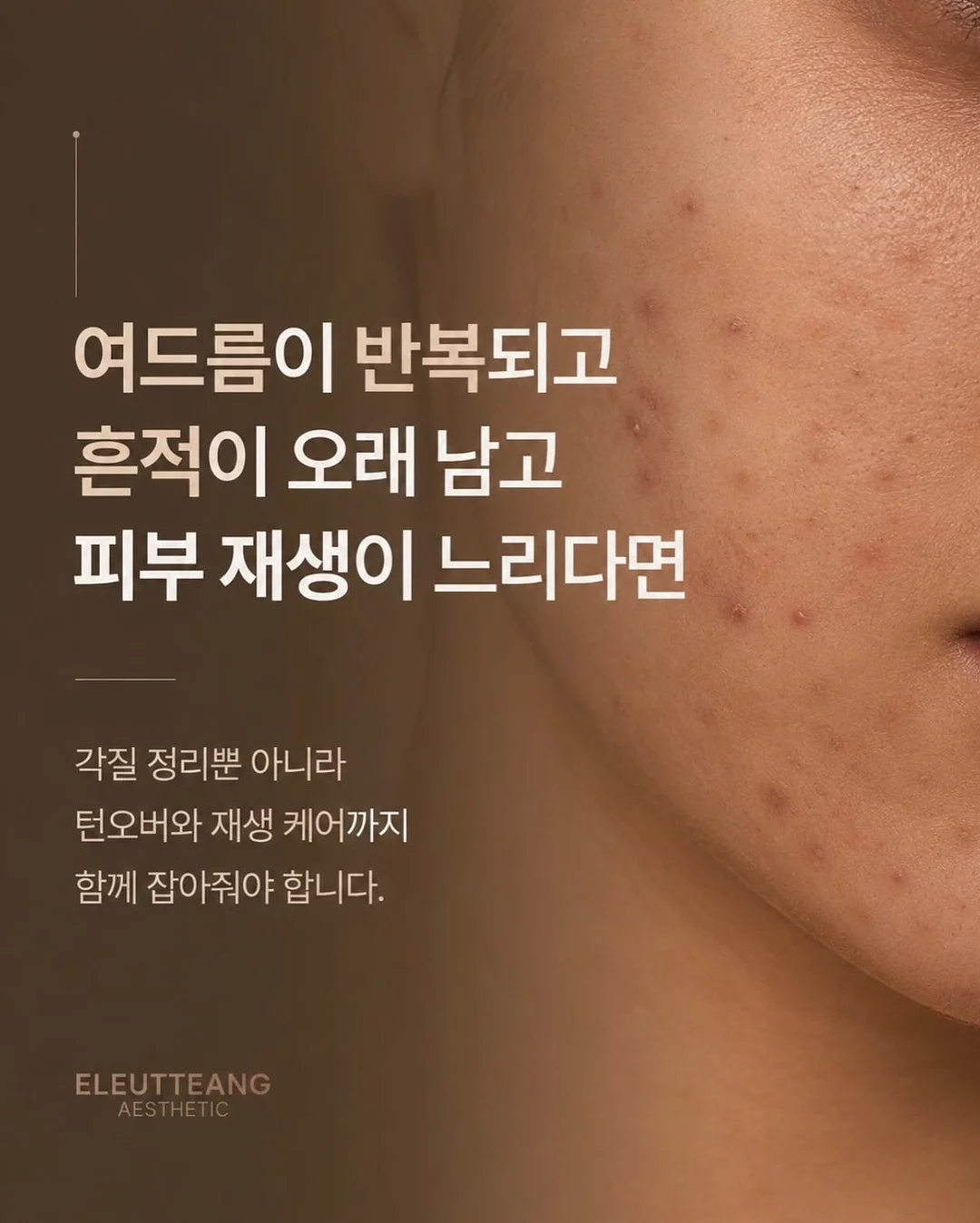 콘텐츠 템플릿 15