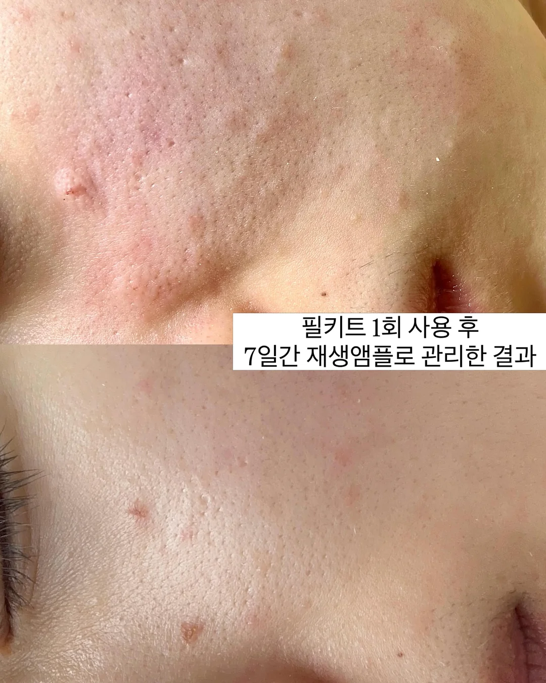 콘텐츠 템플릿 19