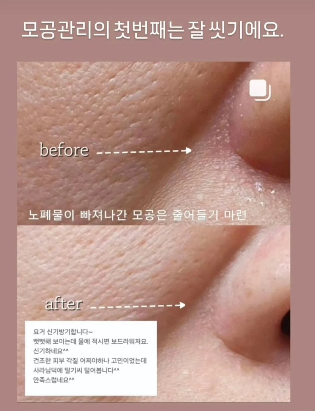 ODETTE & ODILE 뷔스티에 탑 12