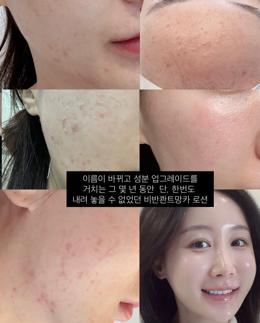 석류틴트 4