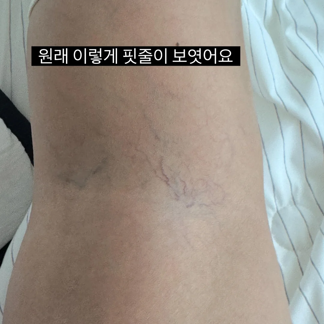 emis 리버시블 숄더백 2