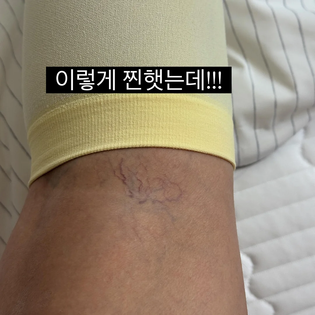 emis 리버시블 숄더백 4