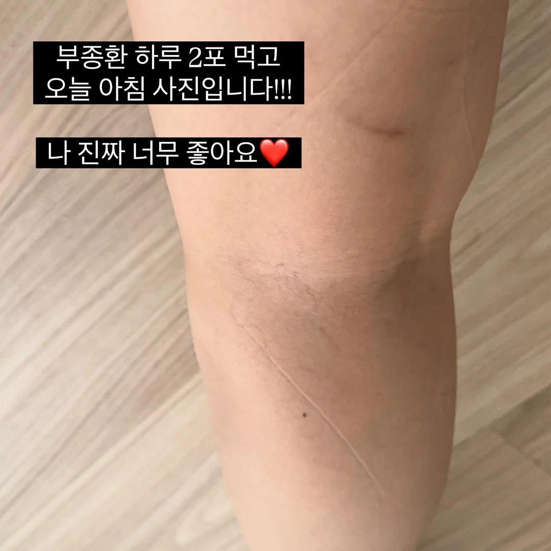 emis 리버시블 숄더백 5