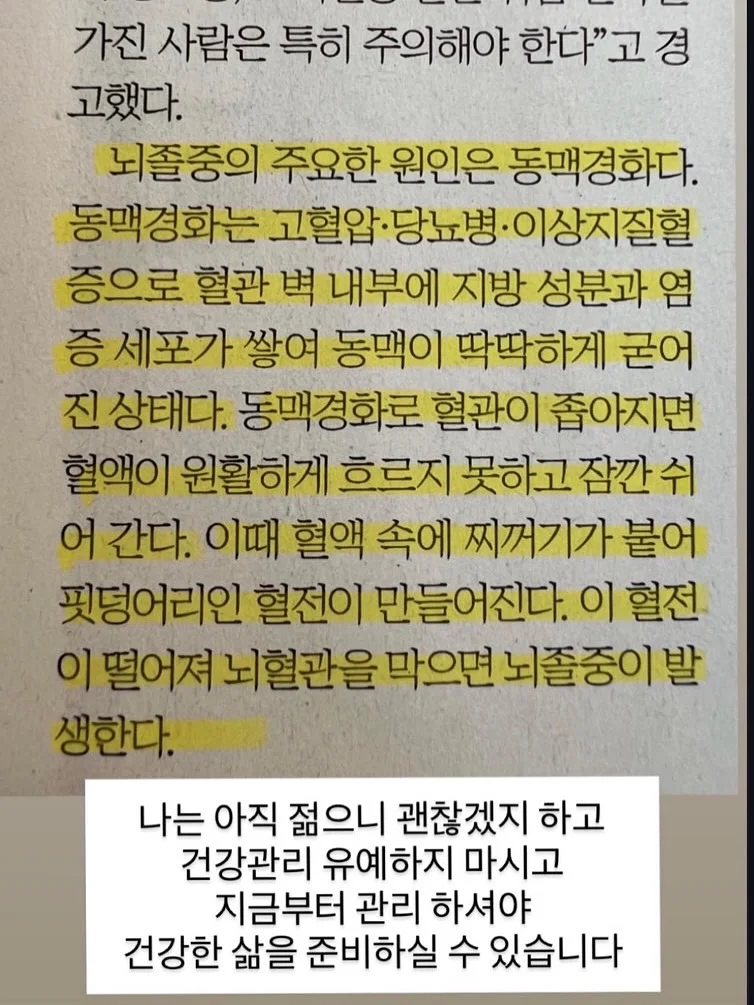 진통 소염 연고 4