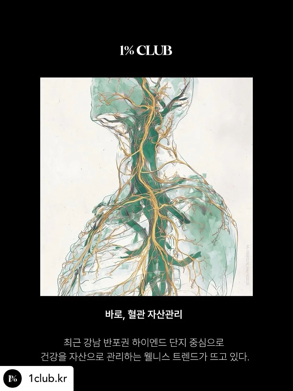 진통 소염 연고 10