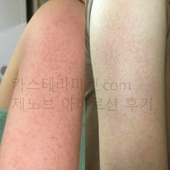 쎄라쥬 뷰티디바이스 1