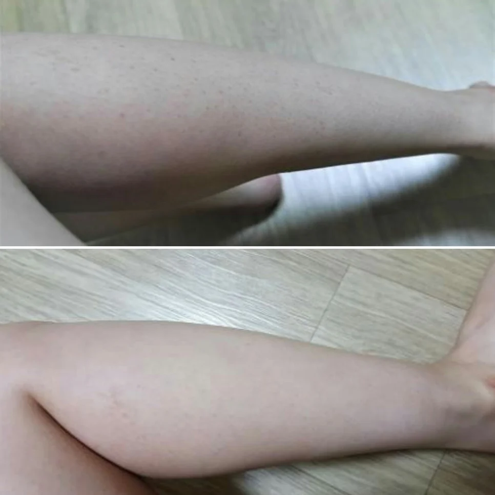 쎄라쥬 뷰티디바이스 2