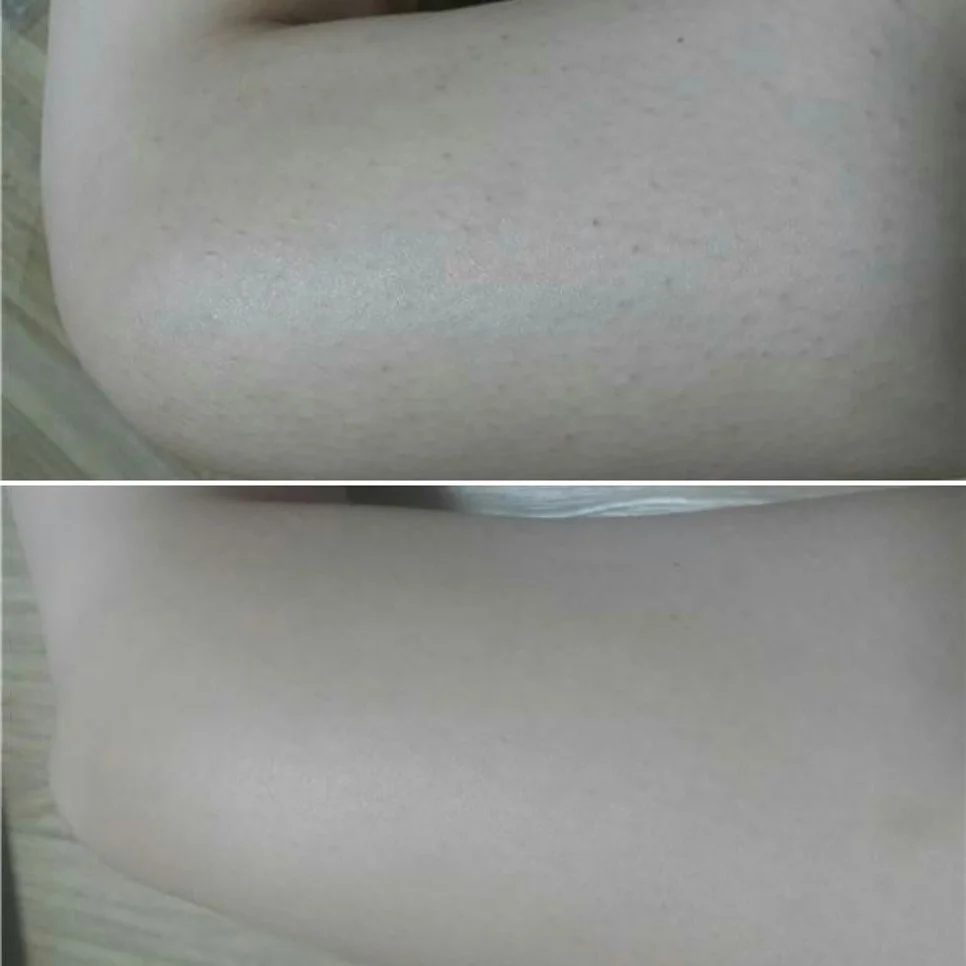 쎄라쥬 뷰티디바이스 3