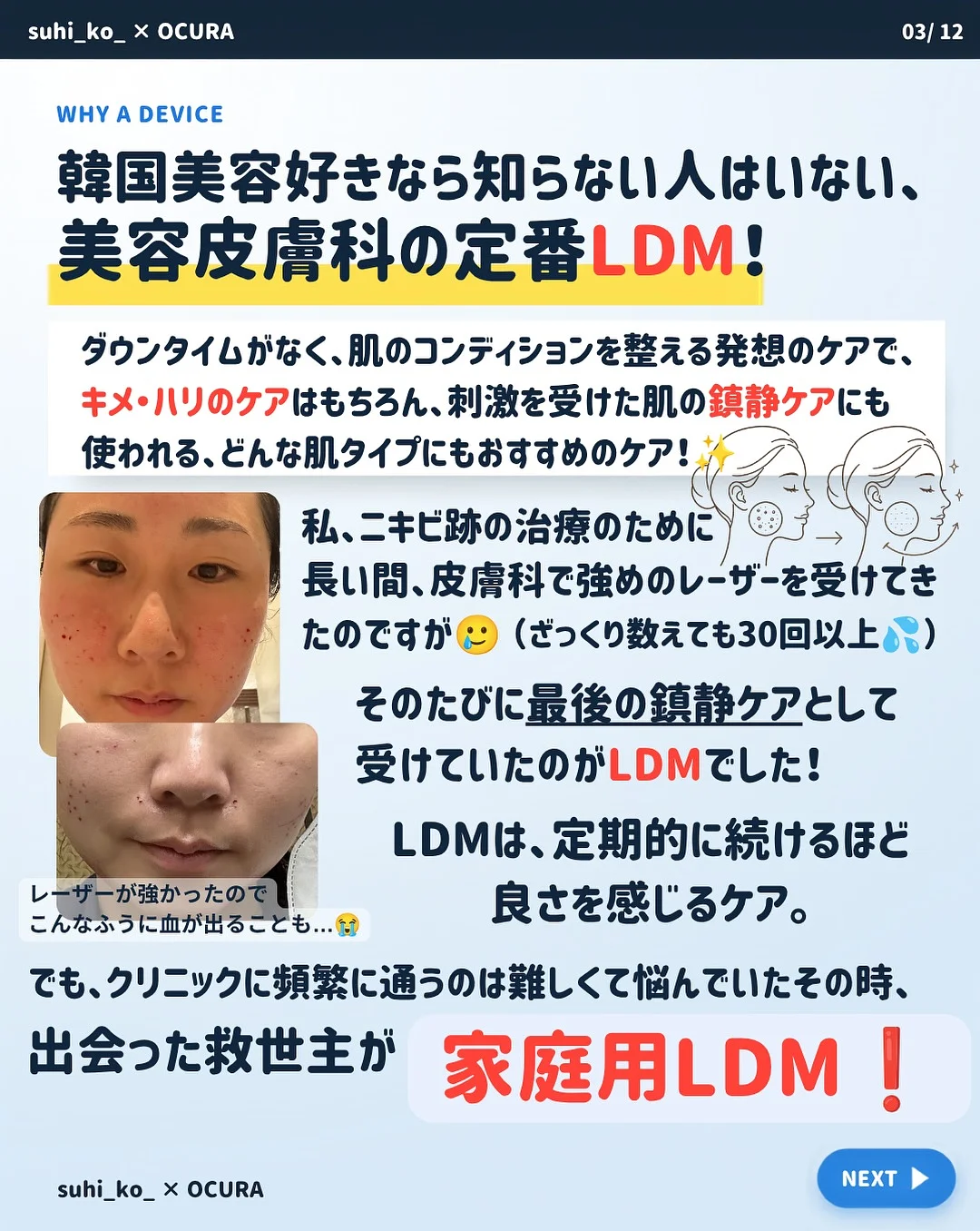 가구 3