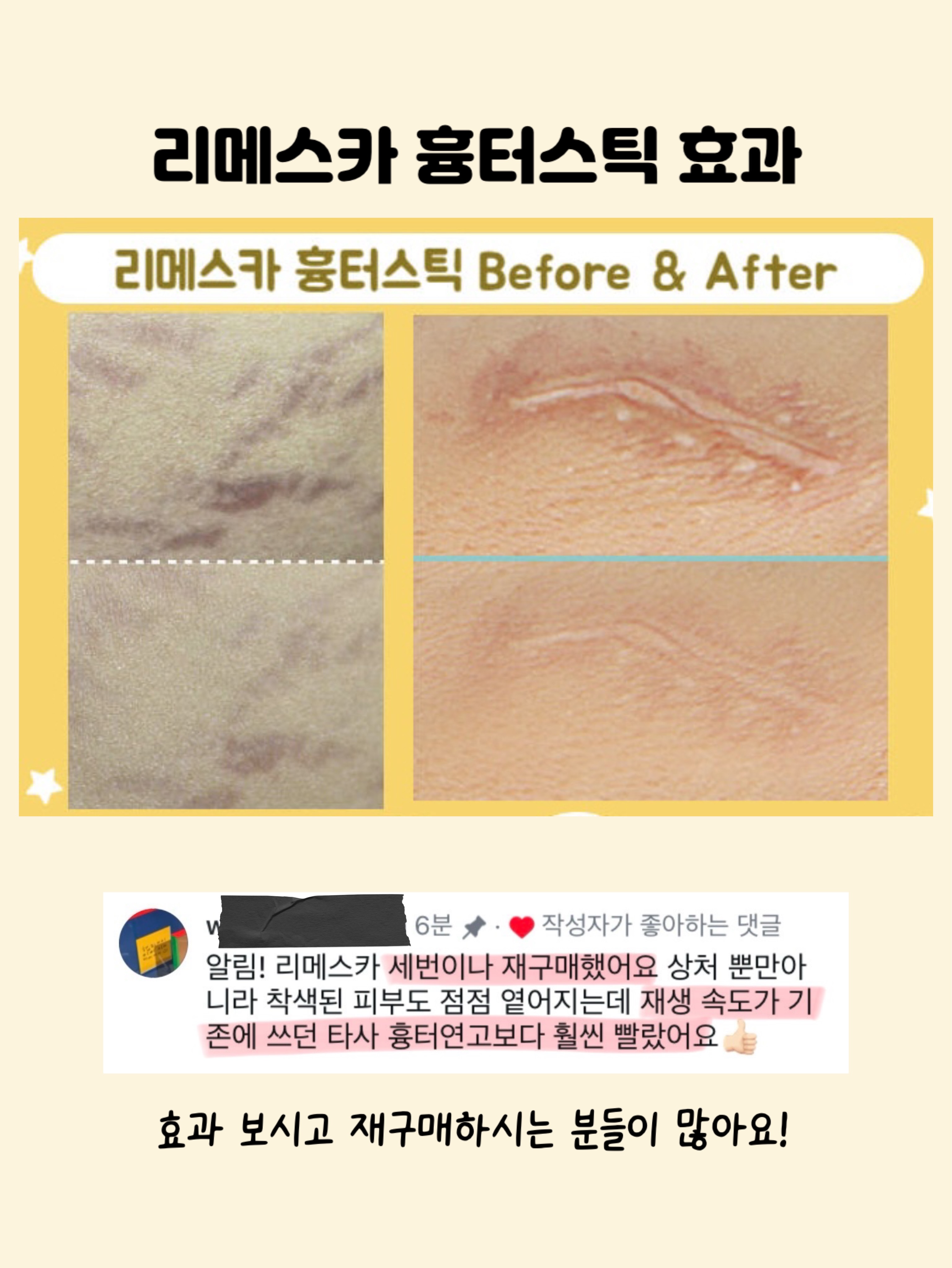 링클 텍스처 셔츠 8