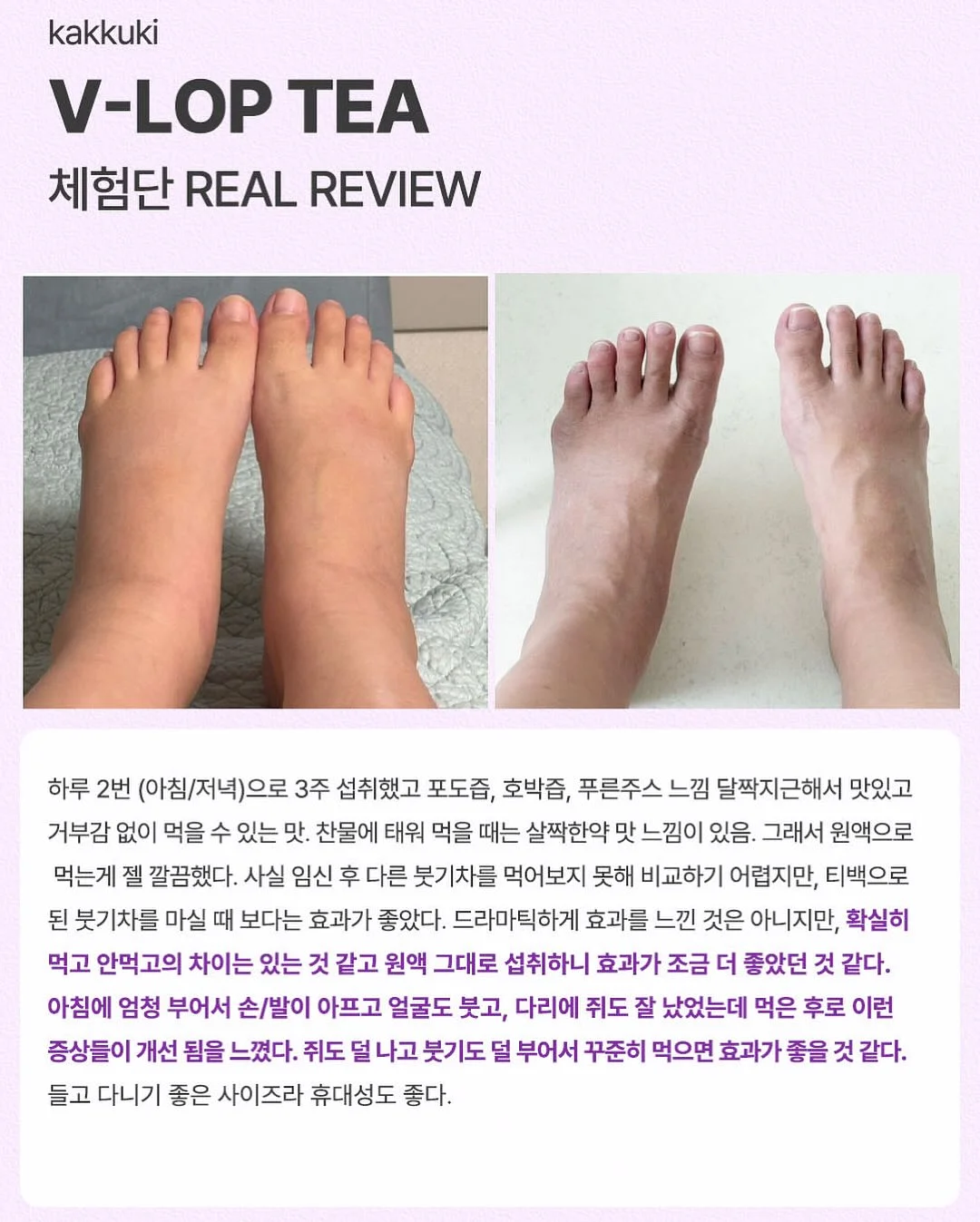 테리나시 셋업 11