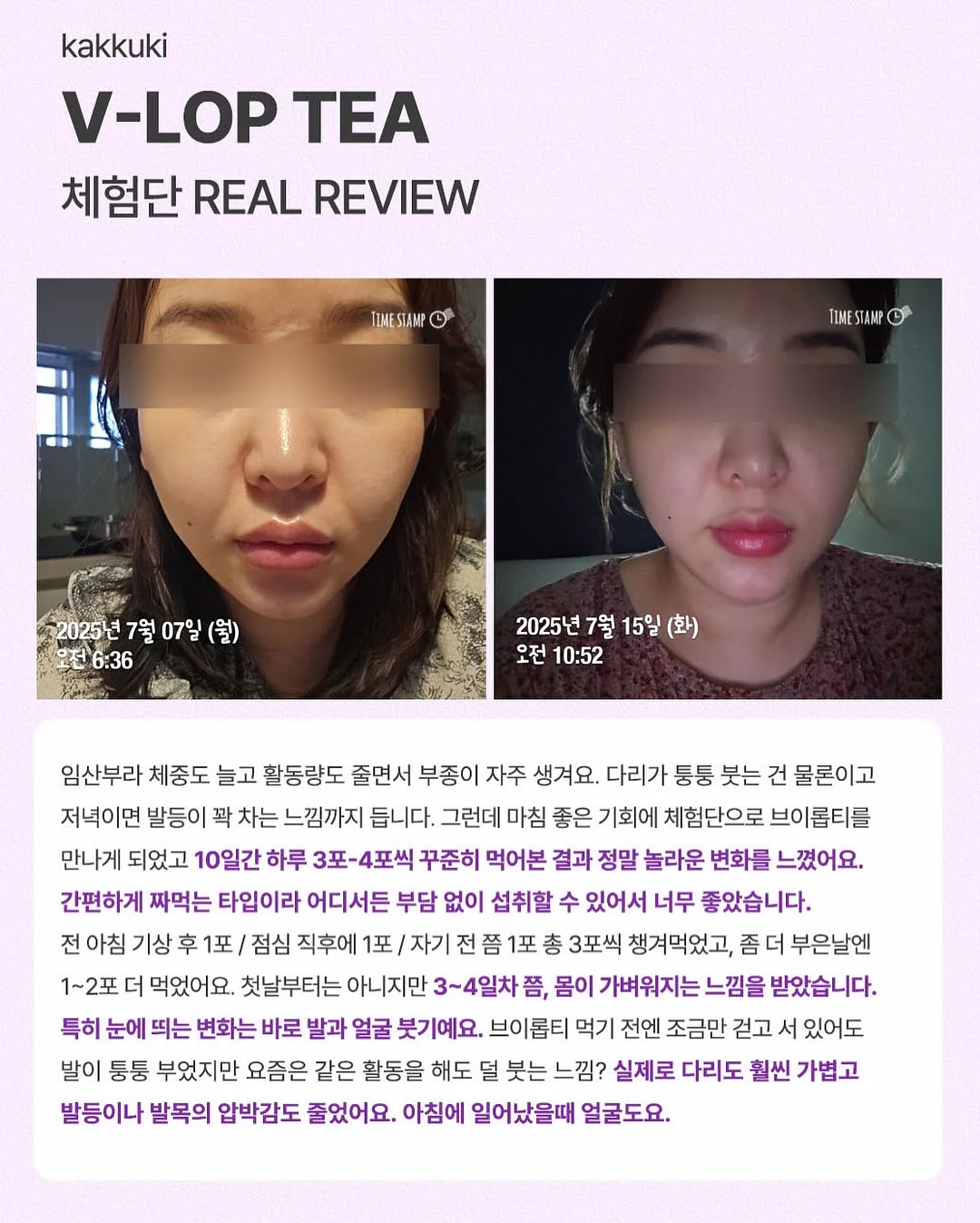 테리나시 셋업 2
