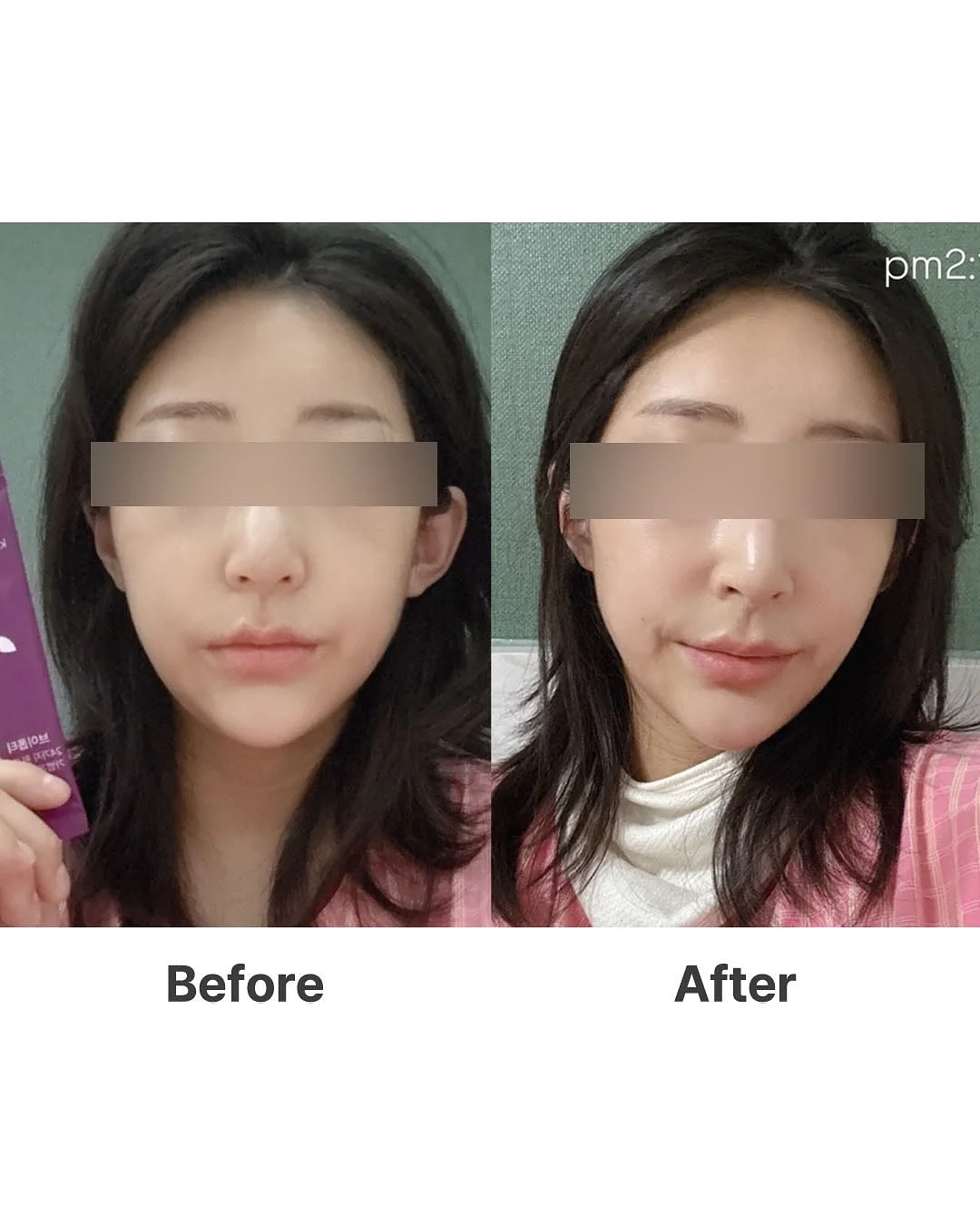 테리나시 셋업 3