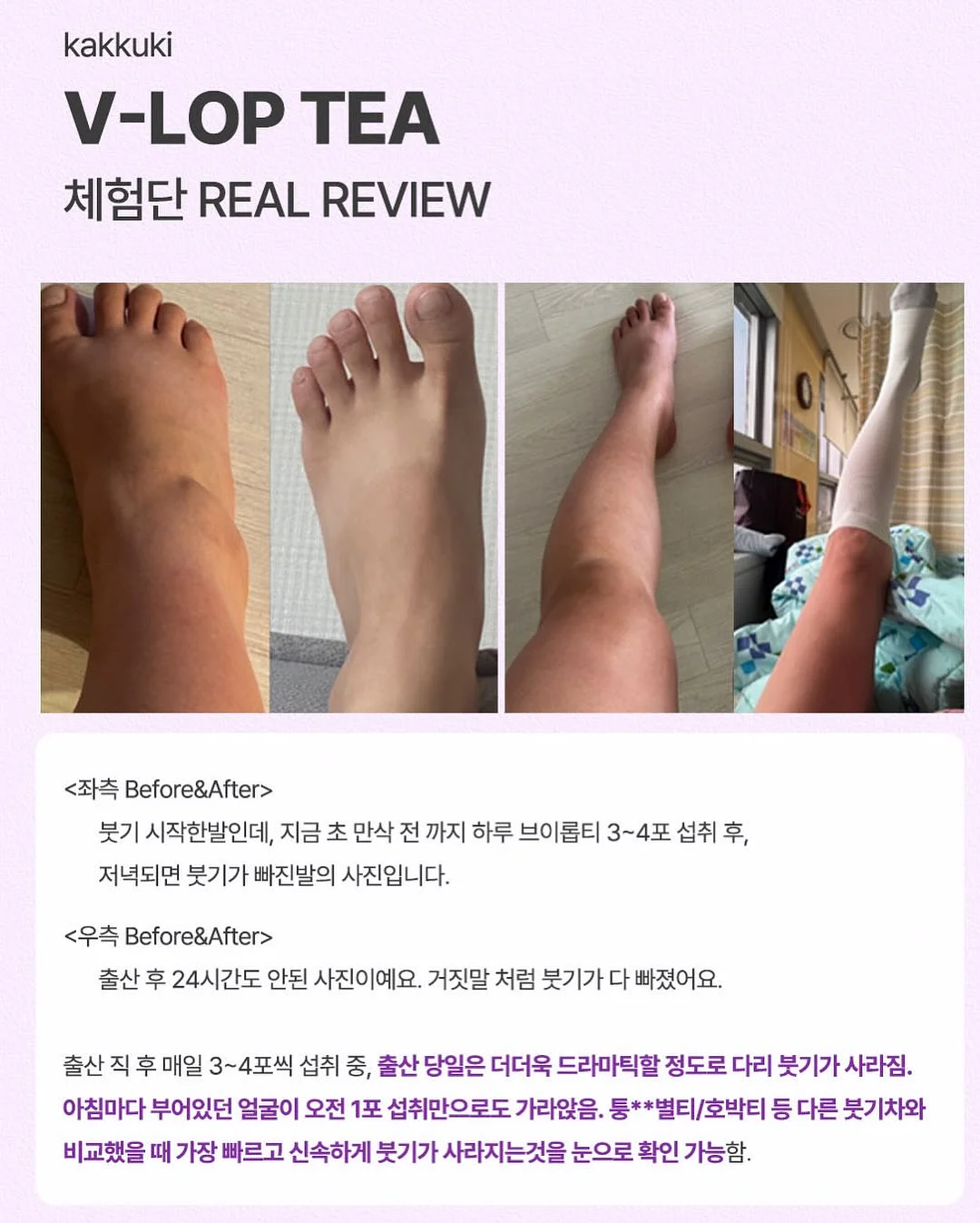 테리나시 셋업 4