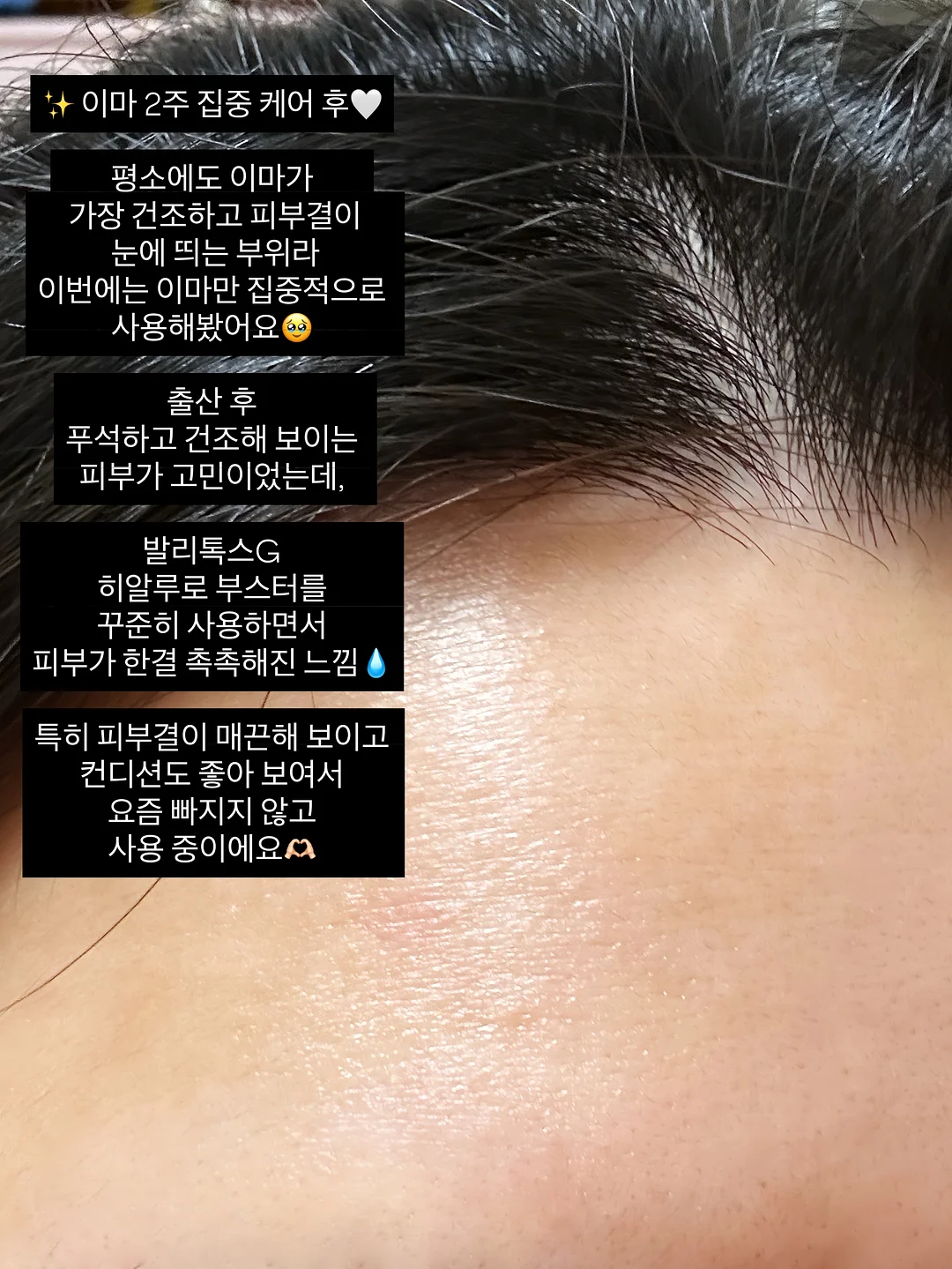 프롬미 블랙모찌 프로그램 8