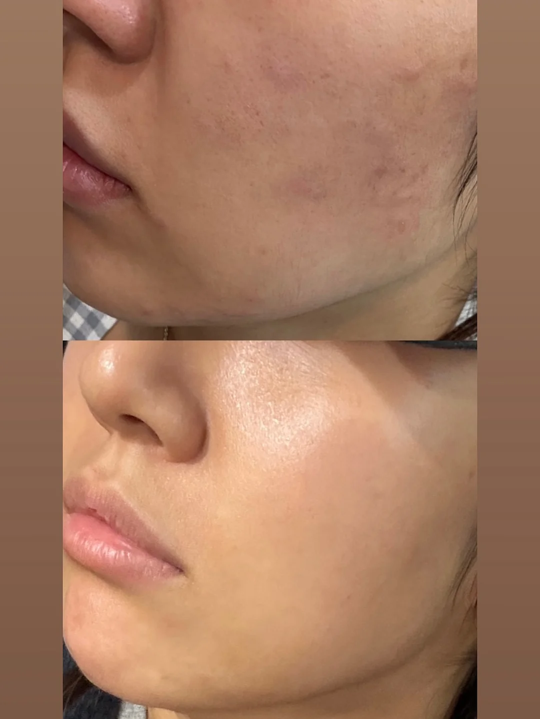 엘플레르 꽃다발 10