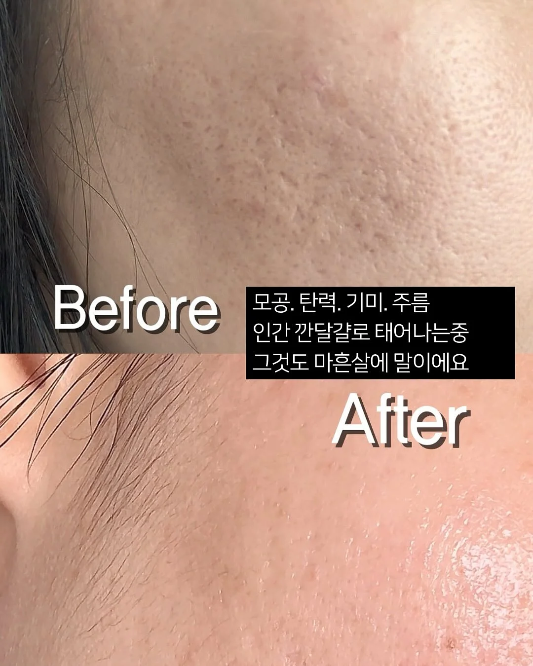 항암 식단 가루 11