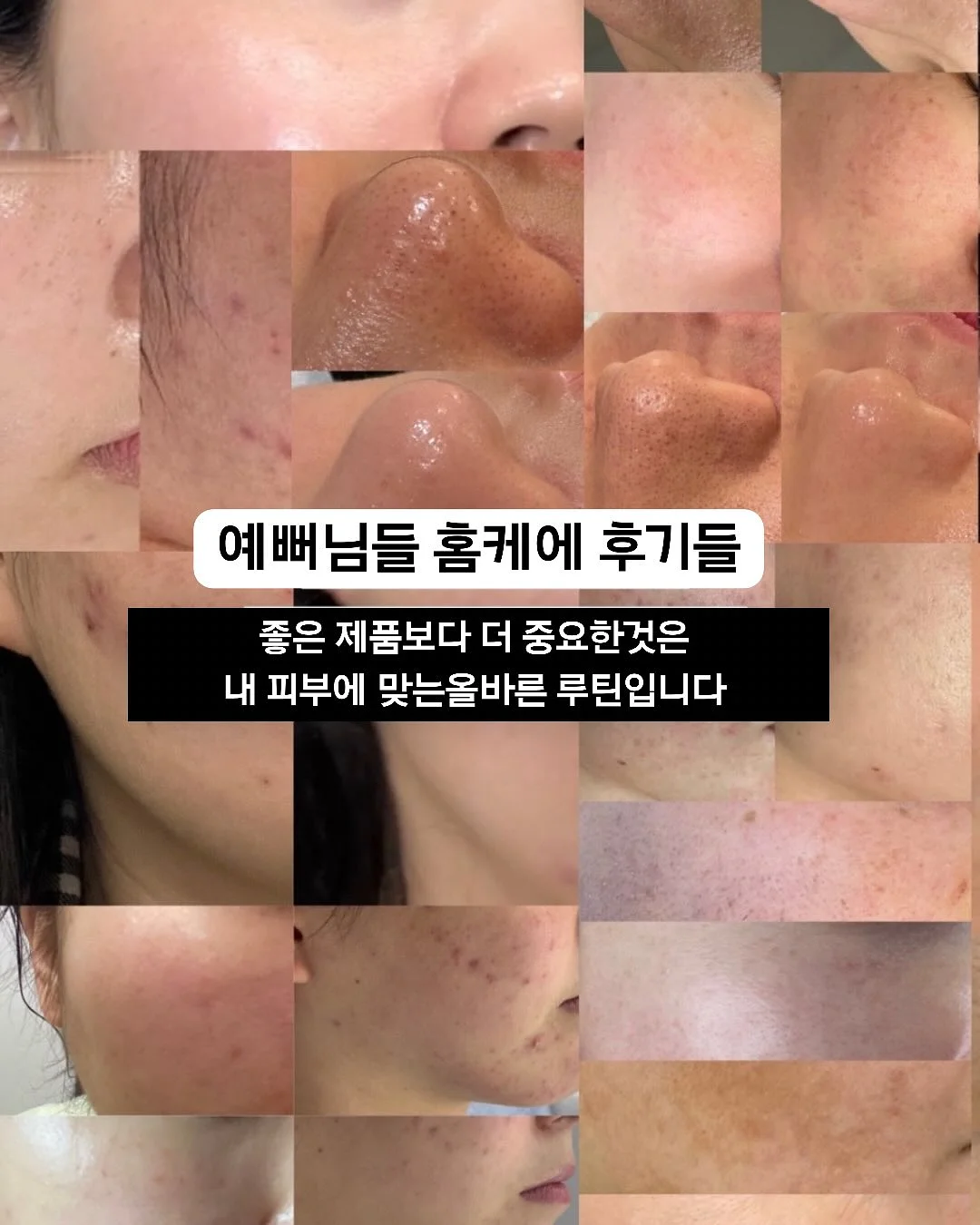 항암 식단 가루 18