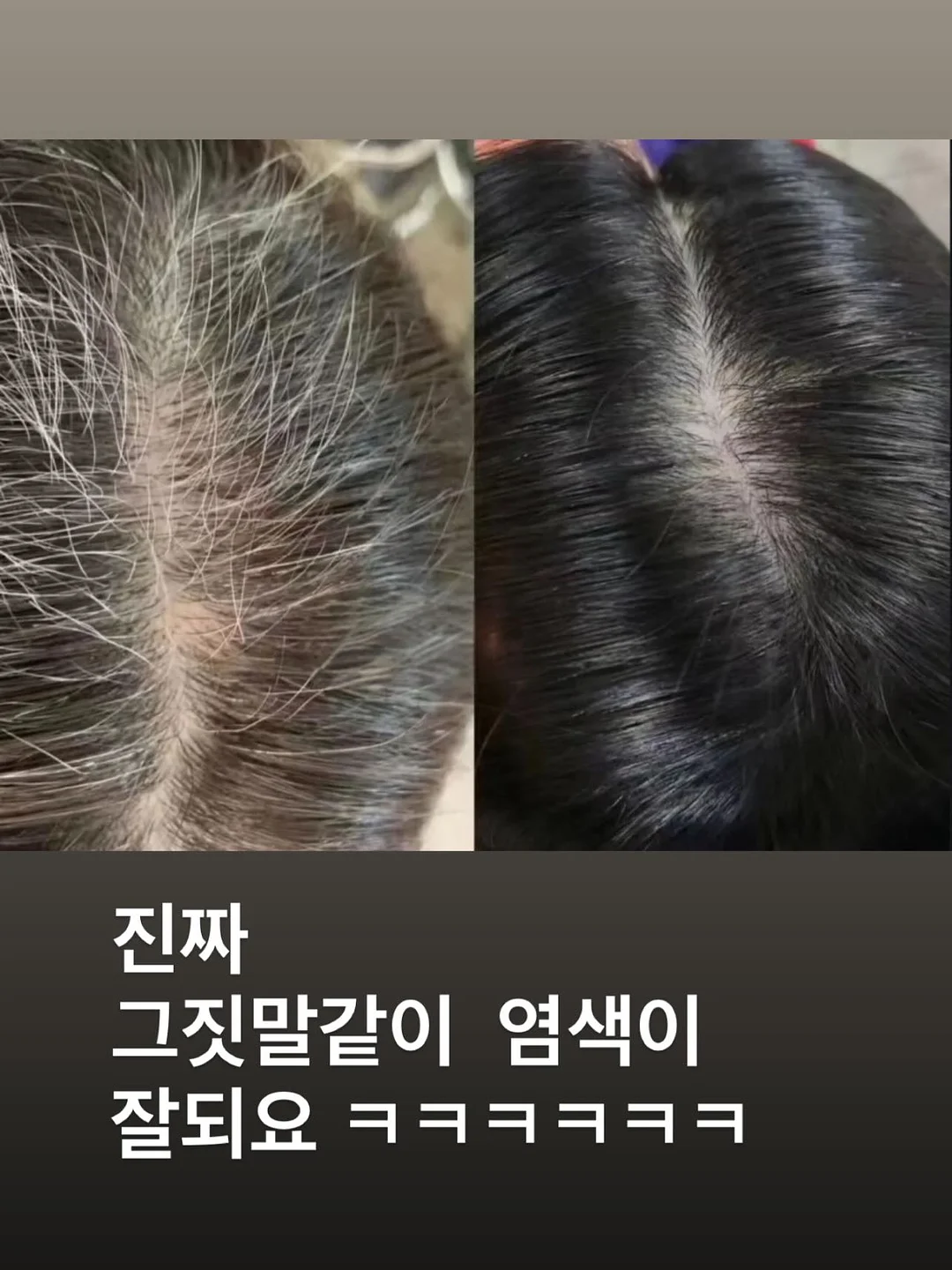 모기 퇴치기 10